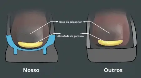 Ammortizzazione tallone