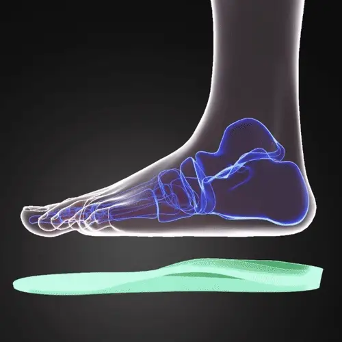 Supporto per l'arco plantare